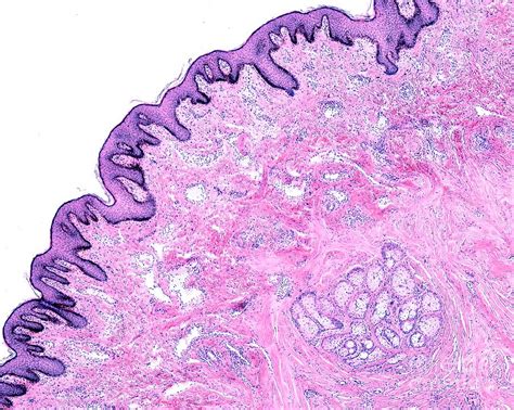 glandulae areolares|areolar glands in humans.